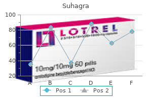 generic suhagra 50mg without a prescription
