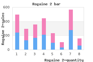 generic rogaine 2 60 ml overnight delivery