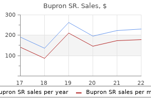 buy 150 mg bupron sr overnight delivery