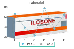 buy 100mg labetalol with mastercard