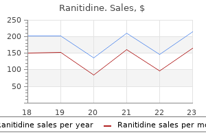 150mg ranitidine with mastercard