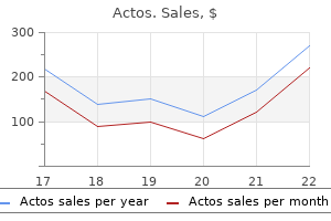 buy actos line