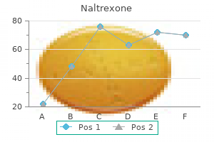 discount naltrexone 50mg visa