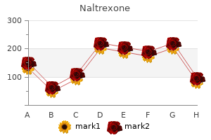 cheap naltrexone 50 mg visa