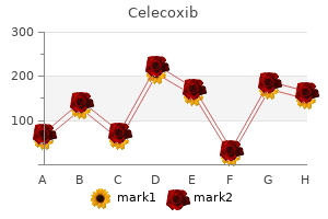 purchase 200mg celecoxib
