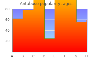 buy antabuse now